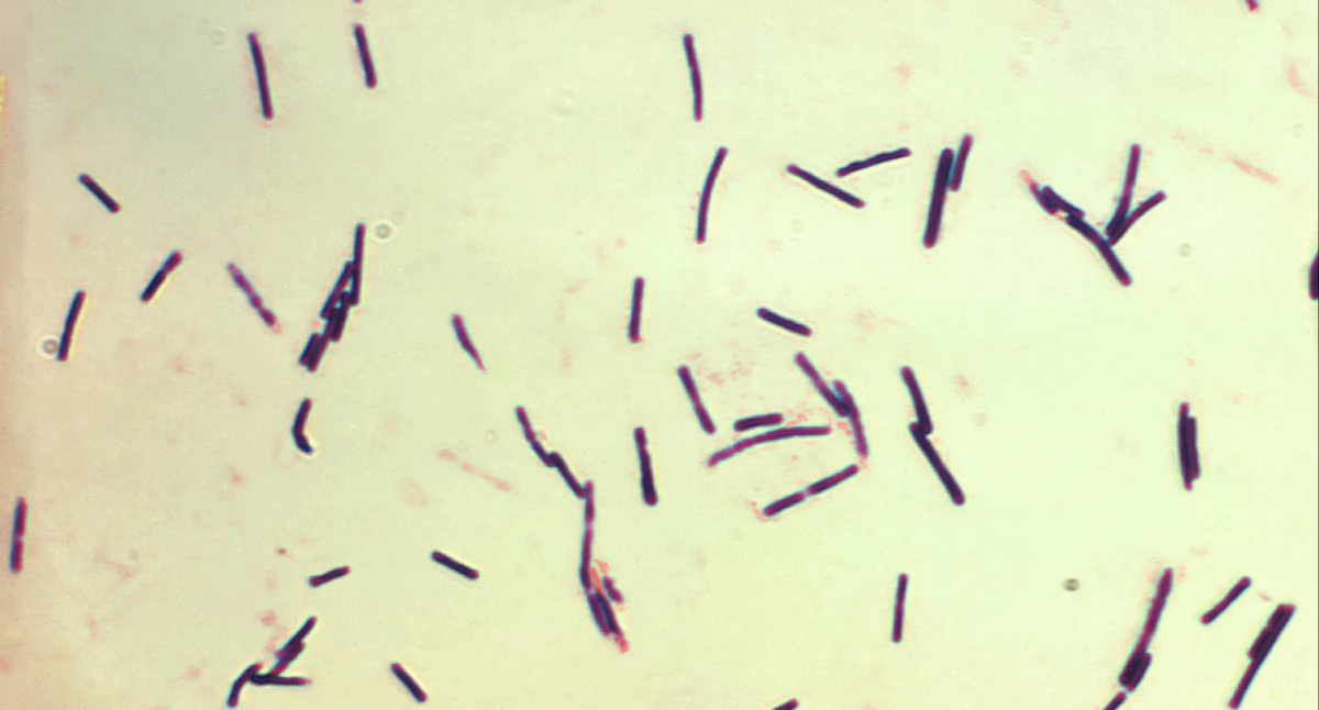 Clostridium perfringens; òdj. CDC/Don Stalons - This media comes from the Centers for Disease Control and Preventions Public Health Image Library (PHIL), with identification number #2995.